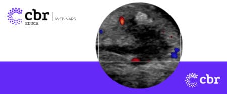 Webinar Ultrassom bolsa testicular