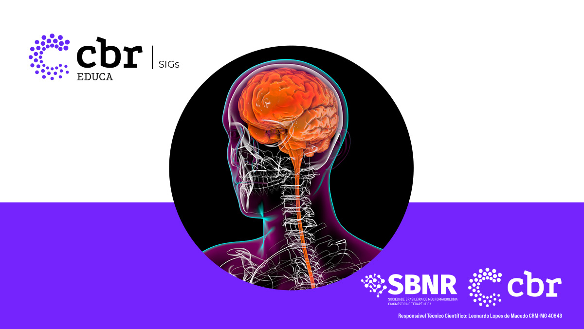 Imagem para o evento: SIG Neuro- Tumores extra-axiais (Meninges, ventrículos e pineal)
